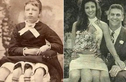 True Story Of Josephine Myrtle Corbin, The Lady Born With Four Legs & Two Private Parts (Photos)